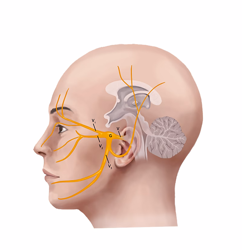 ¿Qué lado afecta el nervio trigémino?