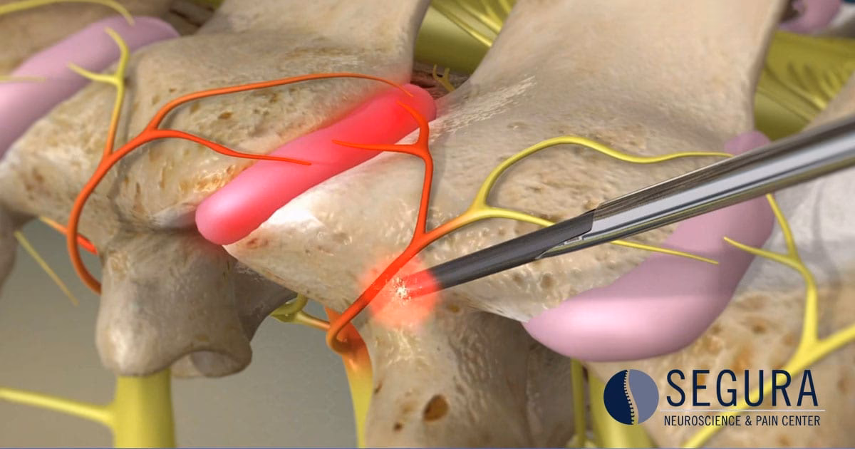 What is the ablation method of studying the brain?