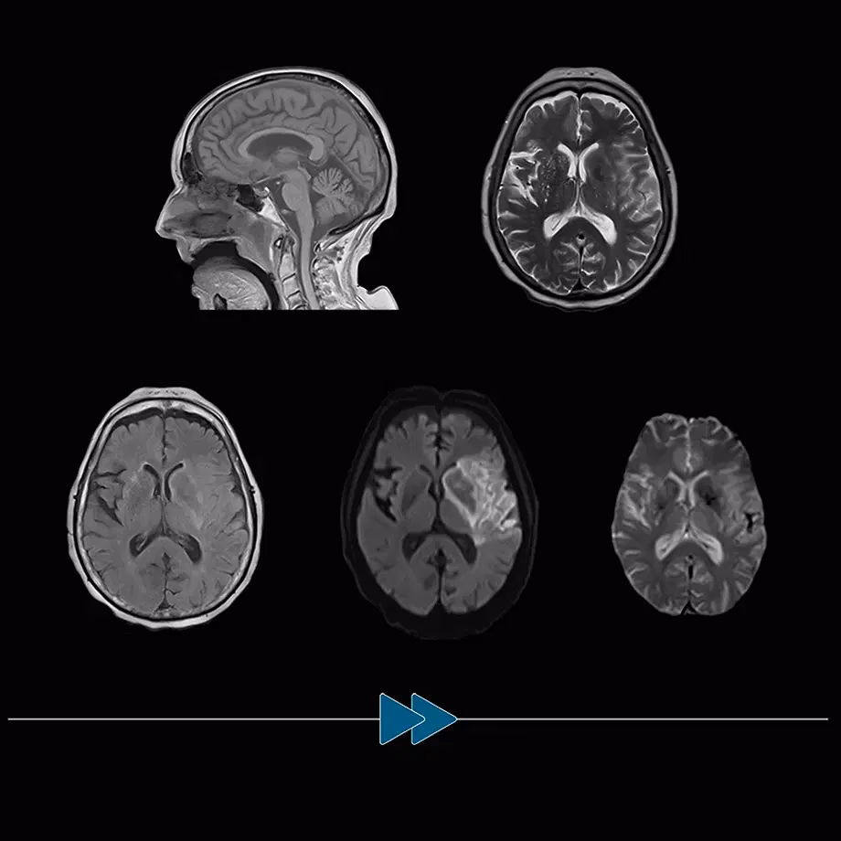 What is the most advanced brain imaging?