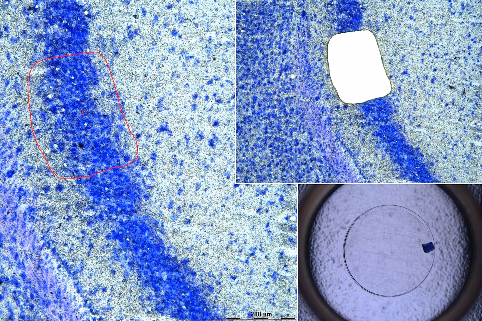 What are the disadvantages of laser capture microdissection?