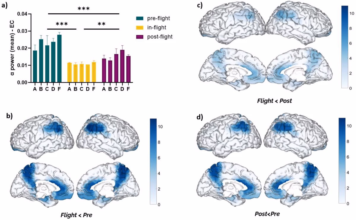 What are the side effects of taking Alpha Brain?