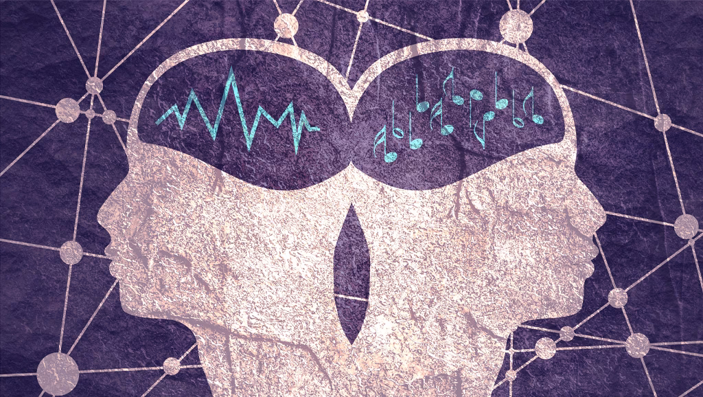 How does music therapy help Alzheimer's?