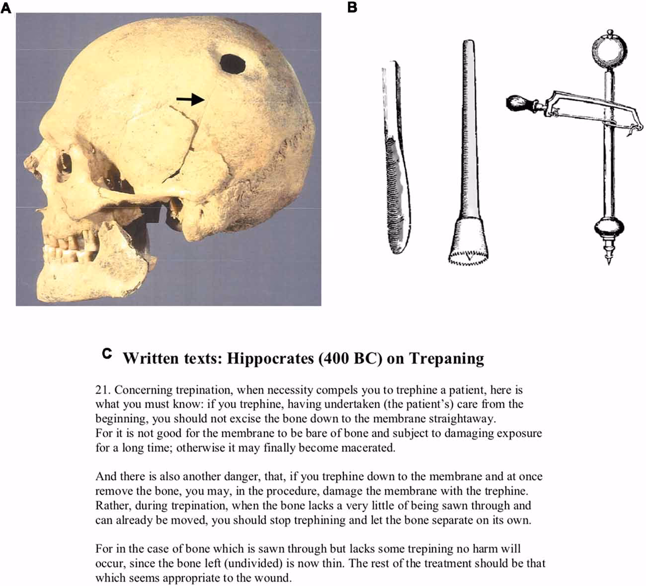 Did ancient Egyptians know about the brain?