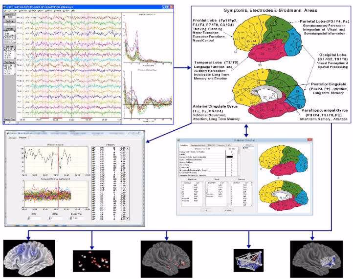 ¿Cómo se utiliza la ciencia de datos en la neurociencia?