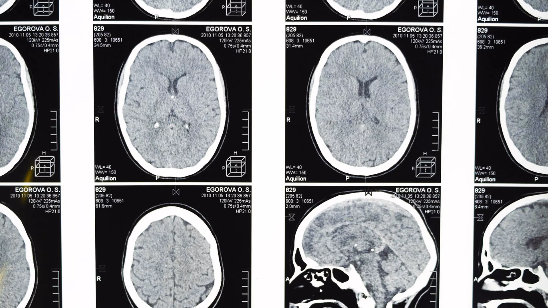 ¿Cuáles son los 10 fundamentos básicos de la neurociencia para la psicología?