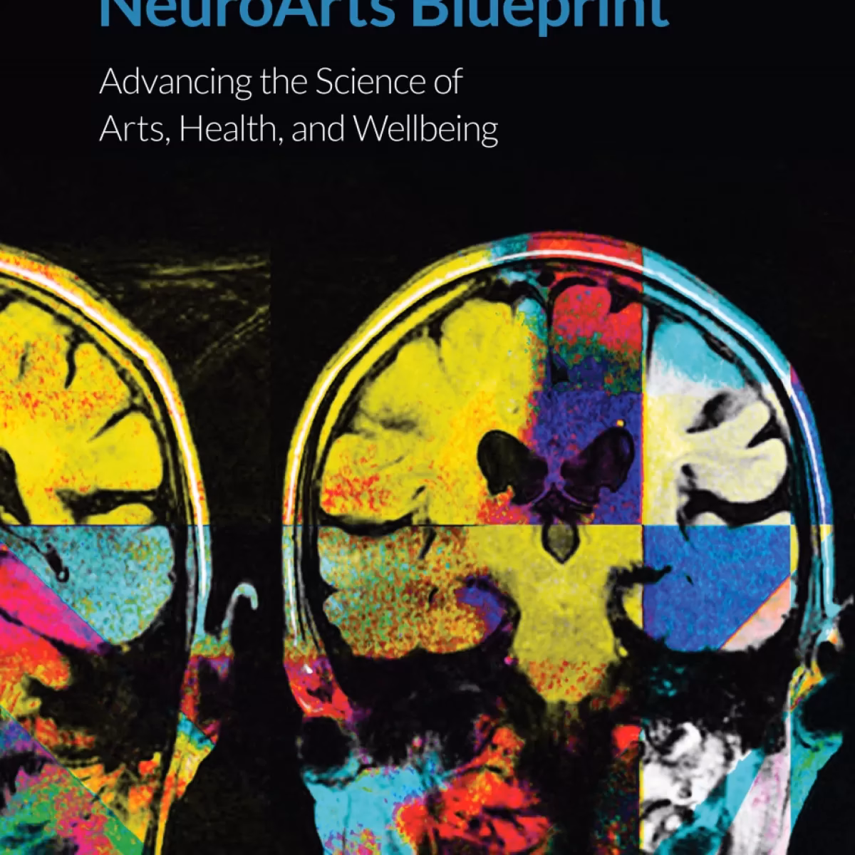 What is the art program for people with dementia?