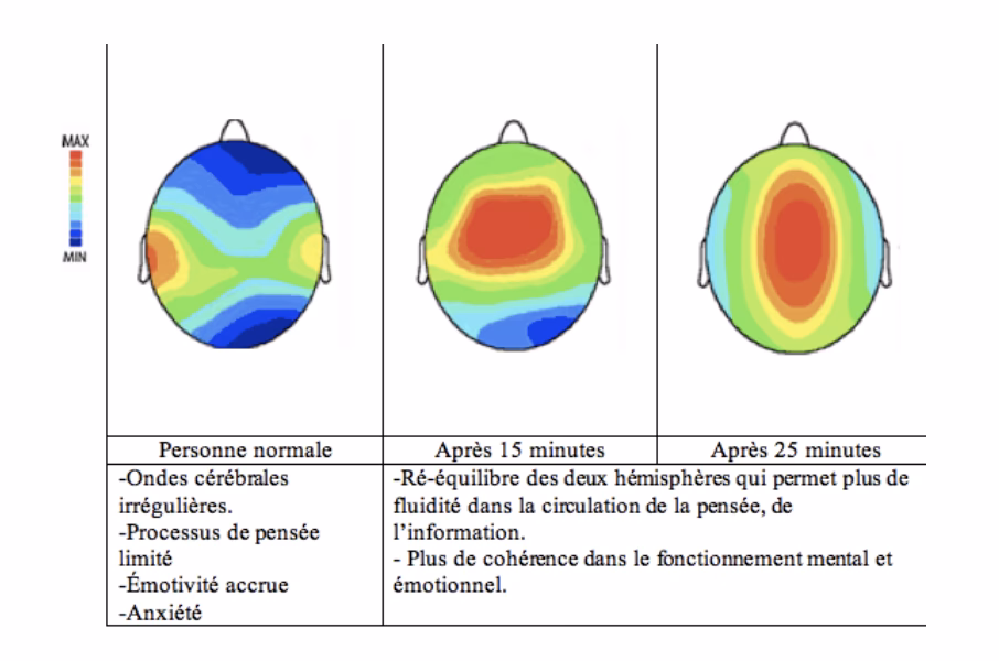¿Qué son y para qué sirven las barras de Access?