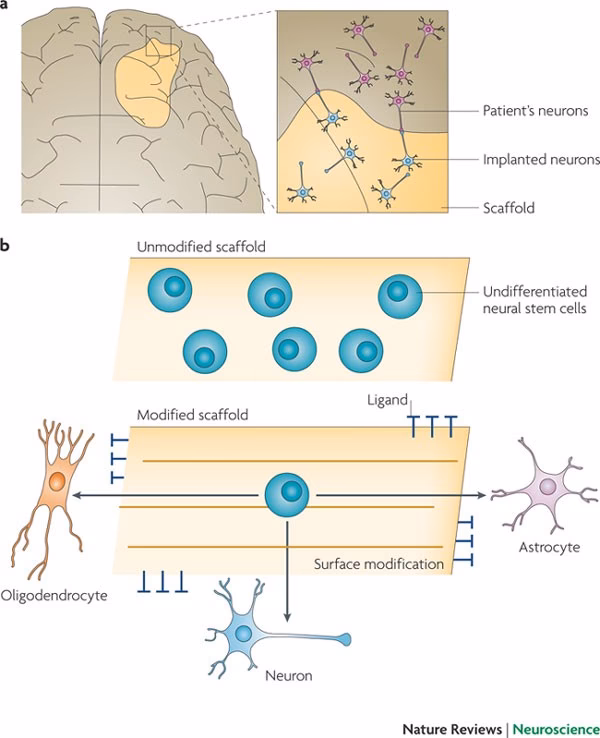 What biomaterials are used in the brain?