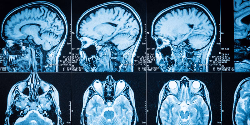What are the three types of biomedical research?