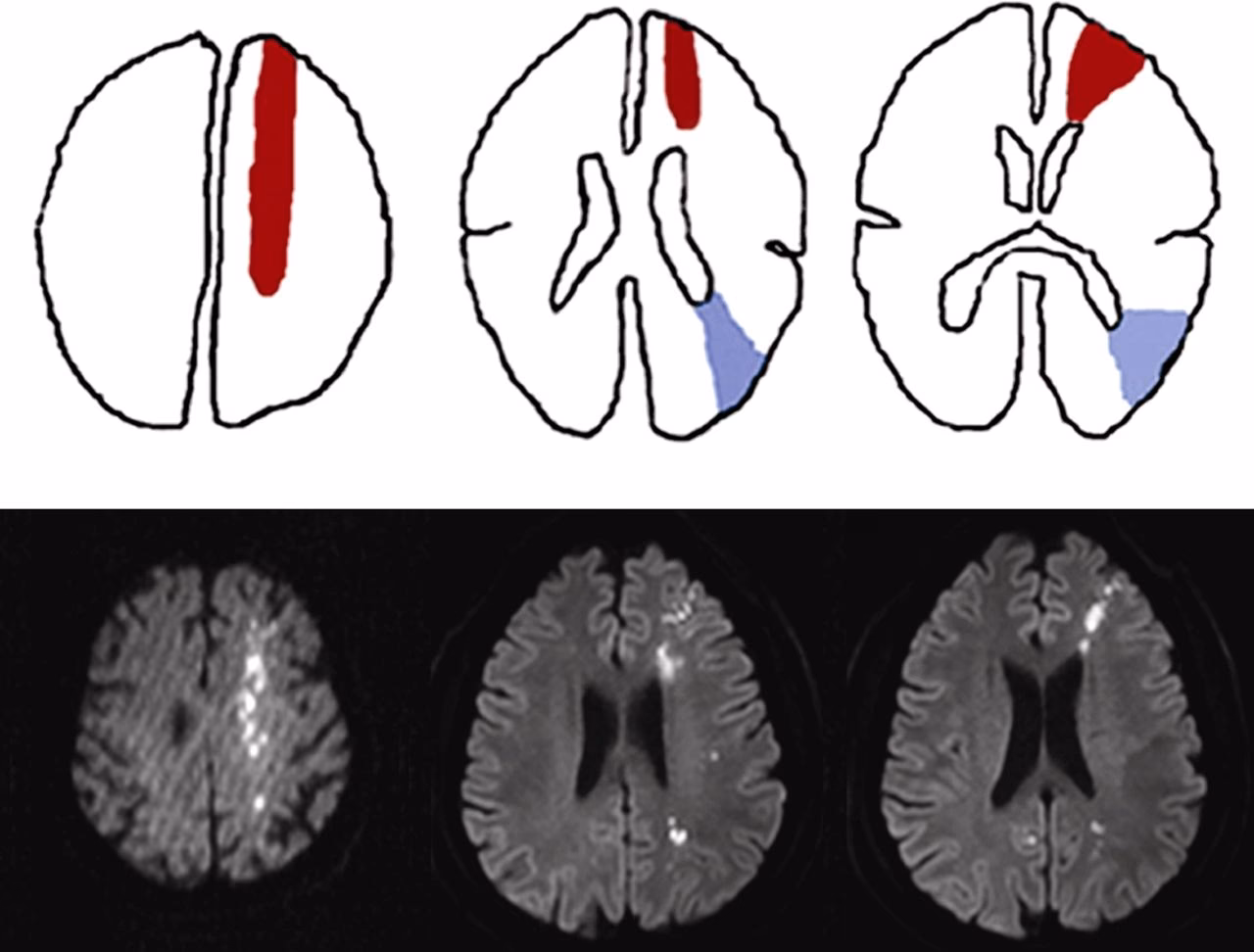 What are the border zones of the brain?