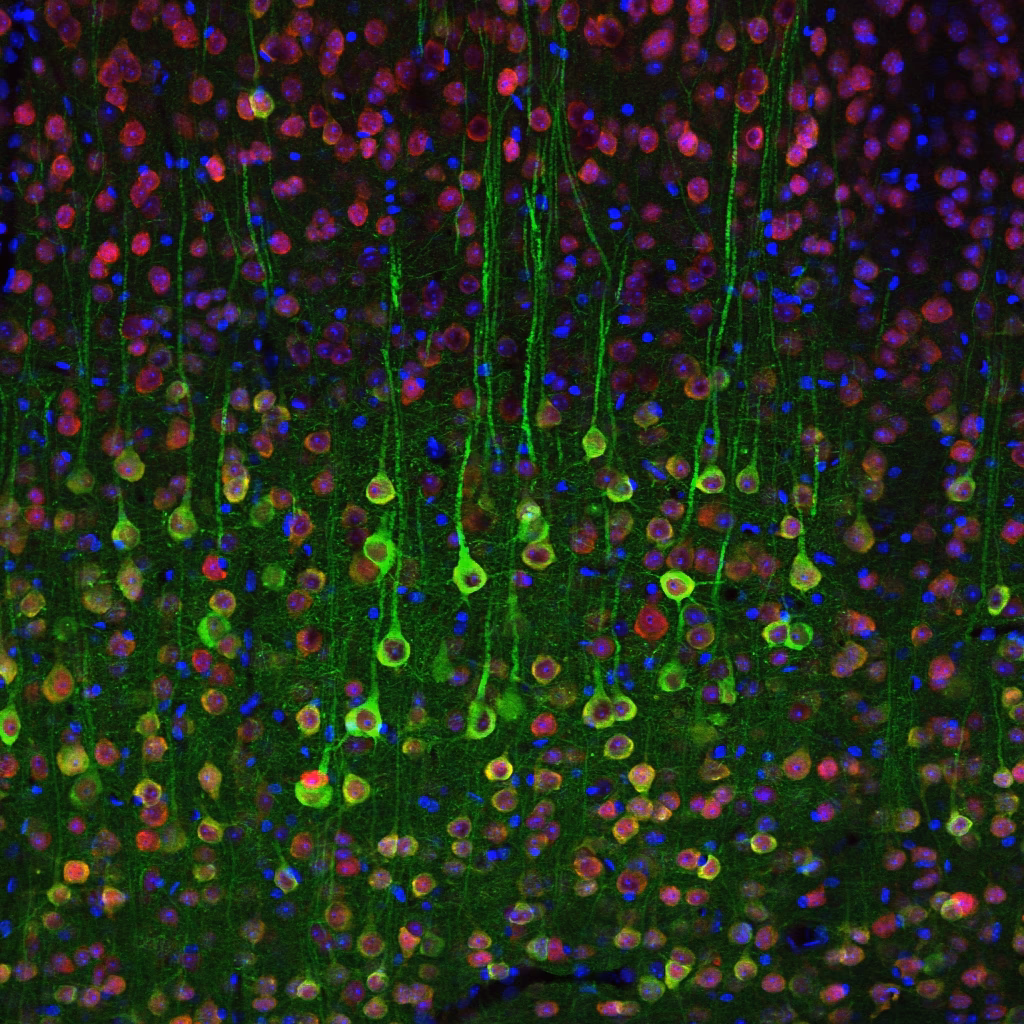 What is calcium imaging in cultured neurons?