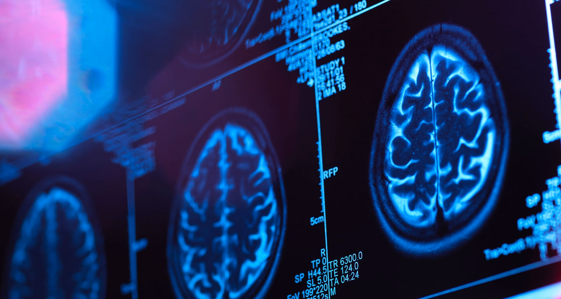 What do you need to major in neuroscience at UAB?