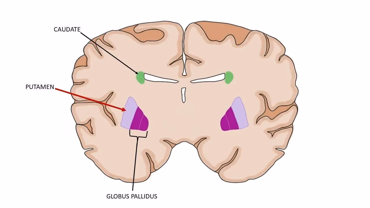 What neurotransmitter is in the caudate?