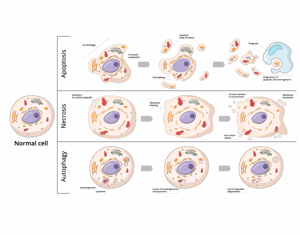 What causes cell death in the brain?