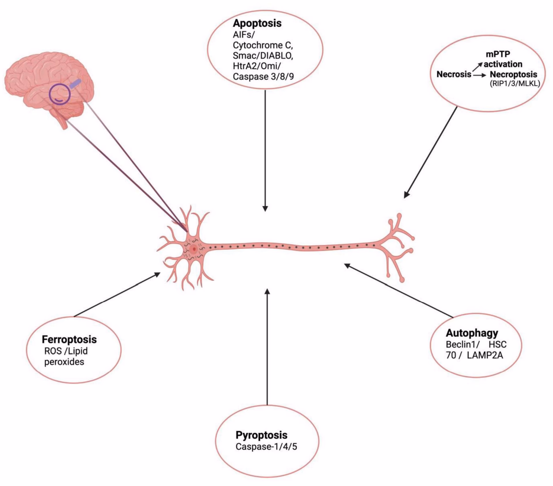 What neurodegenerative disorders are associated with apoptosis?