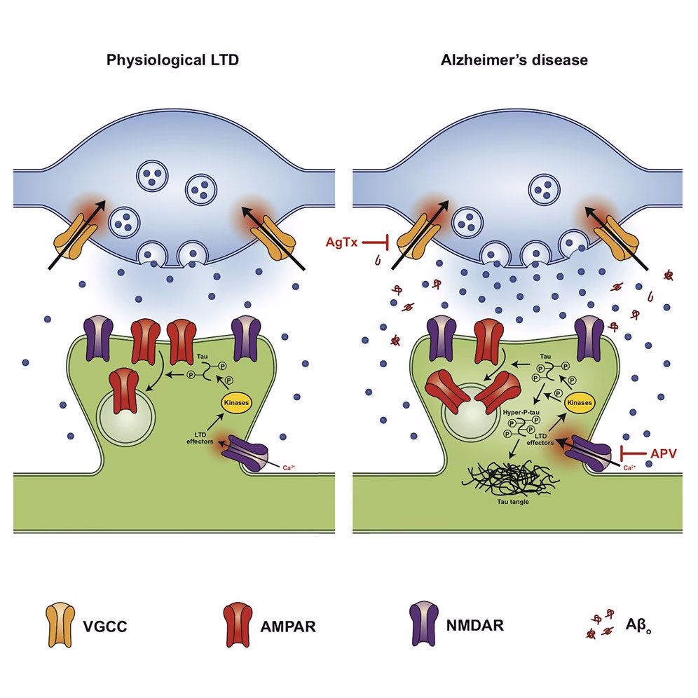 What is Alzheimer's caused by a buildup of?