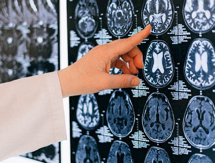 ¿Quién es el mejor investigador en neurociencia del mundo?