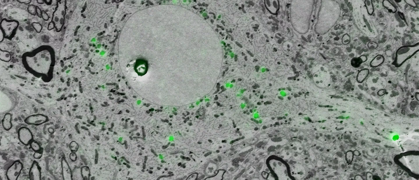 What is a cryo CLEM?