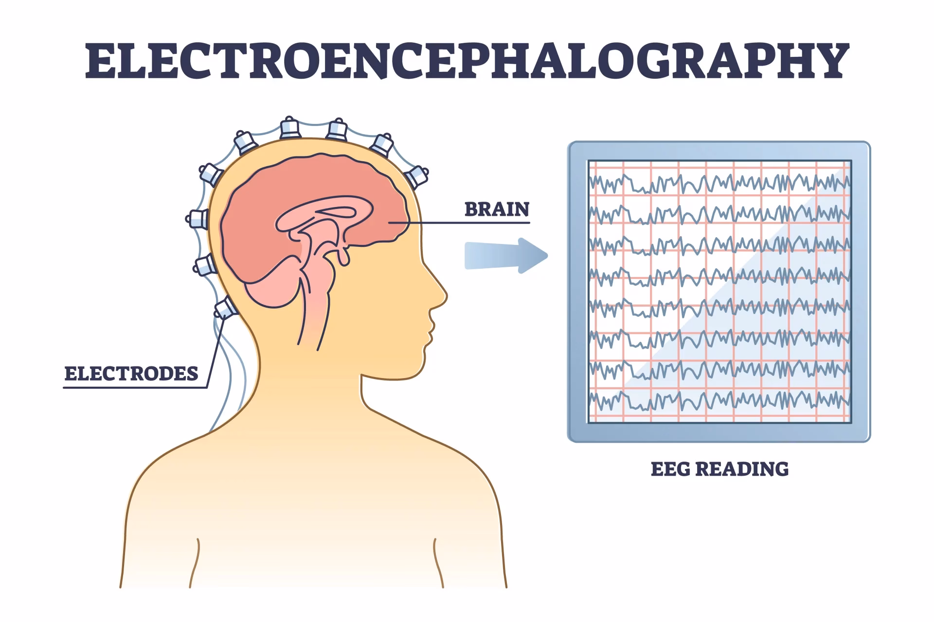 What is the abbreviation for EEG in psychology?