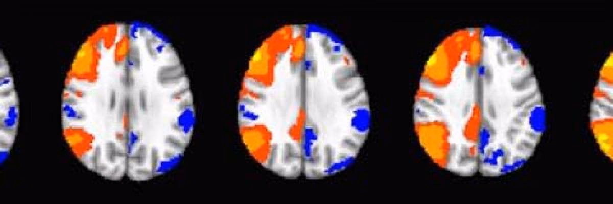 Does UGA have fMRI?