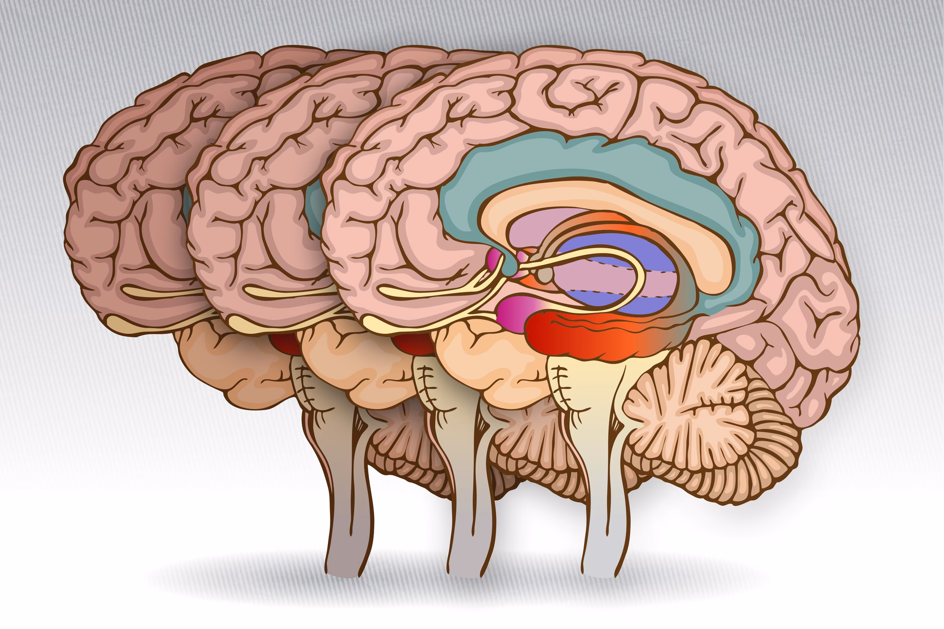 What are three examples of common cognitive changes associated with dementia?