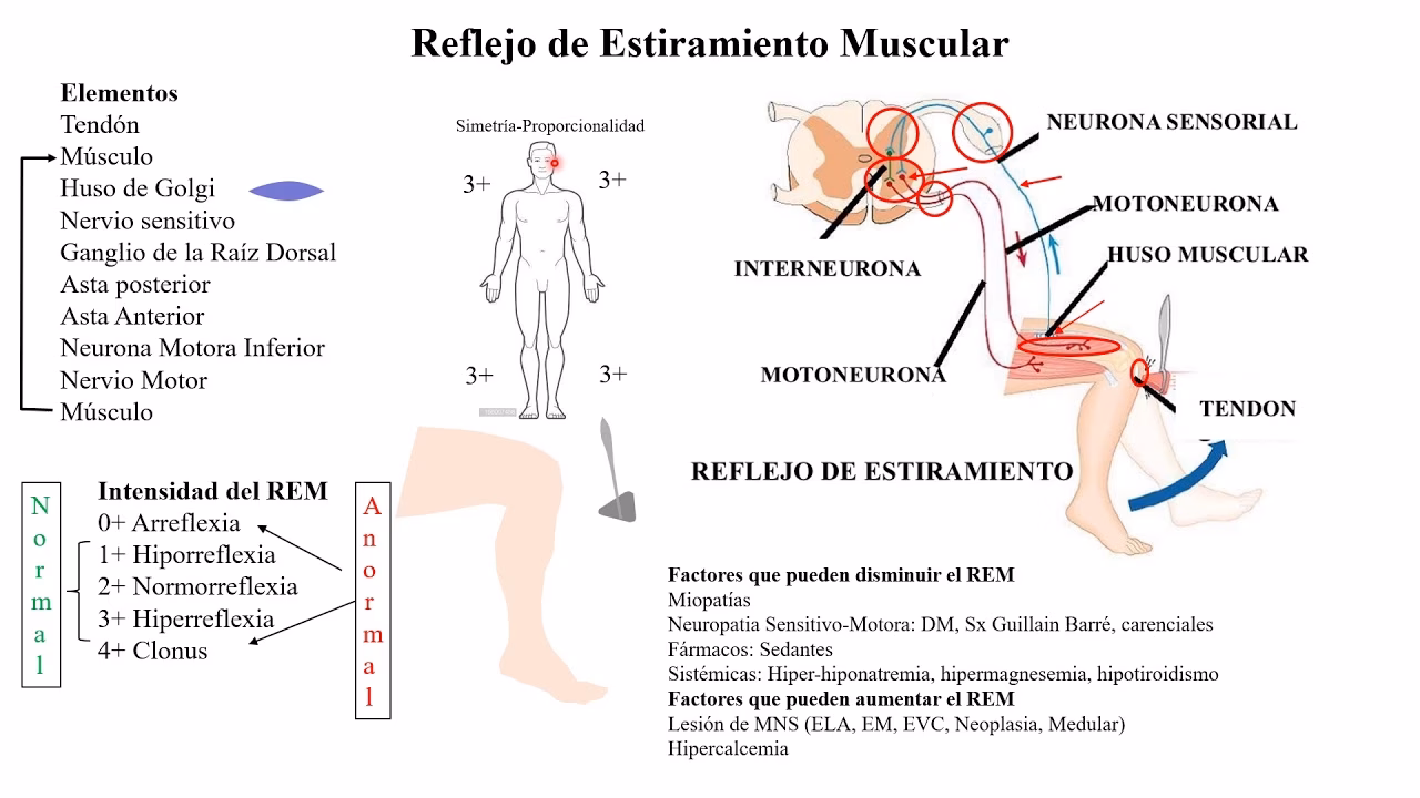 ¿Cuáles son los 4 tipos de reflejos?
