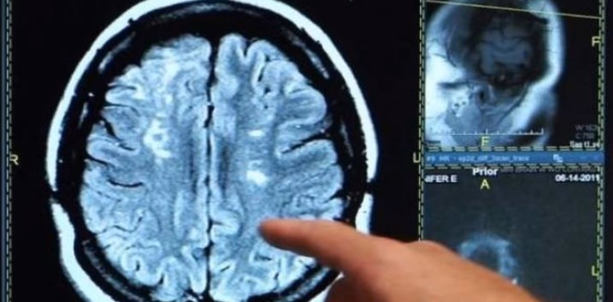 ¿Qué pasa físicamente cuando te rompen el corazón?