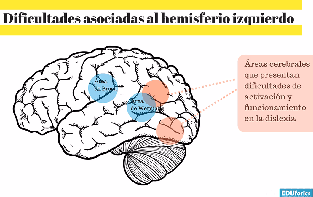 ¿Qué hace la parte frontal izquierda del cerebro?