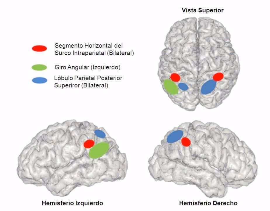 ¿Qué parte del cerebro se ve afectada por la discalculia?