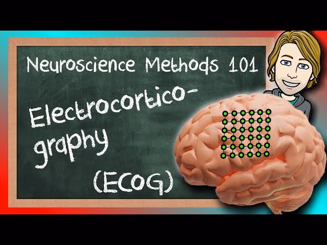 What is the principle of ECoG?