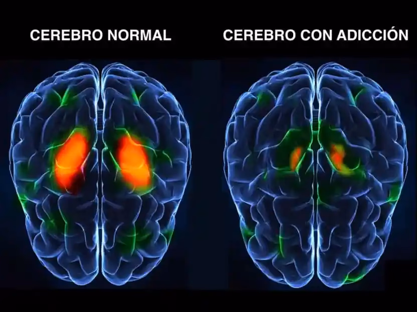 ¿Cuáles son los efectos neurológicos del alcohol?