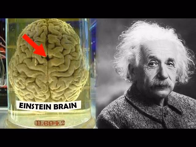 Who has the highest brain in the world?