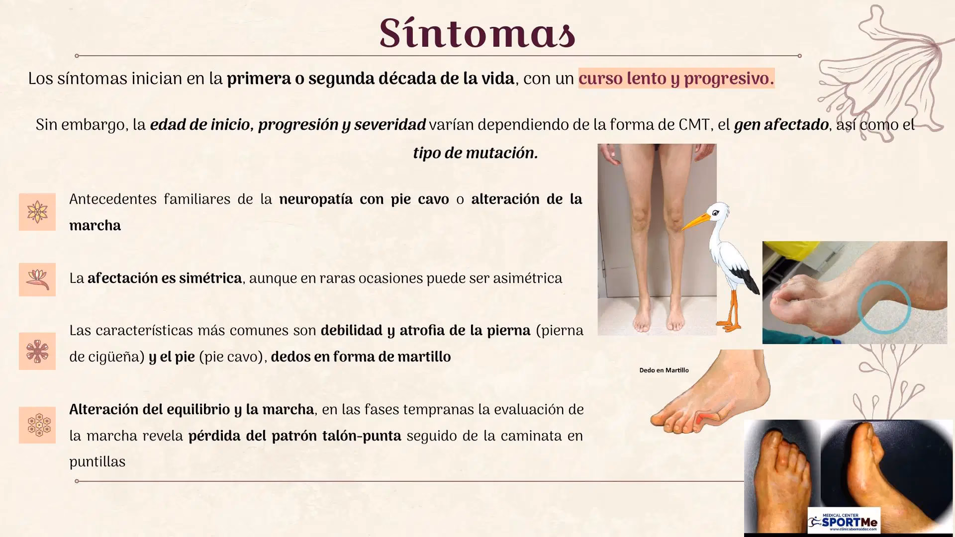 ¿Cuáles son las nuevas investigaciones sobre Charcot Marie Tooth?