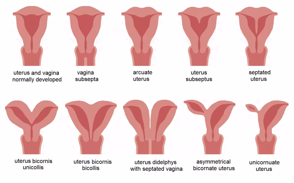 ¿Qué enfermedades puede tener una mujer en el vientre?