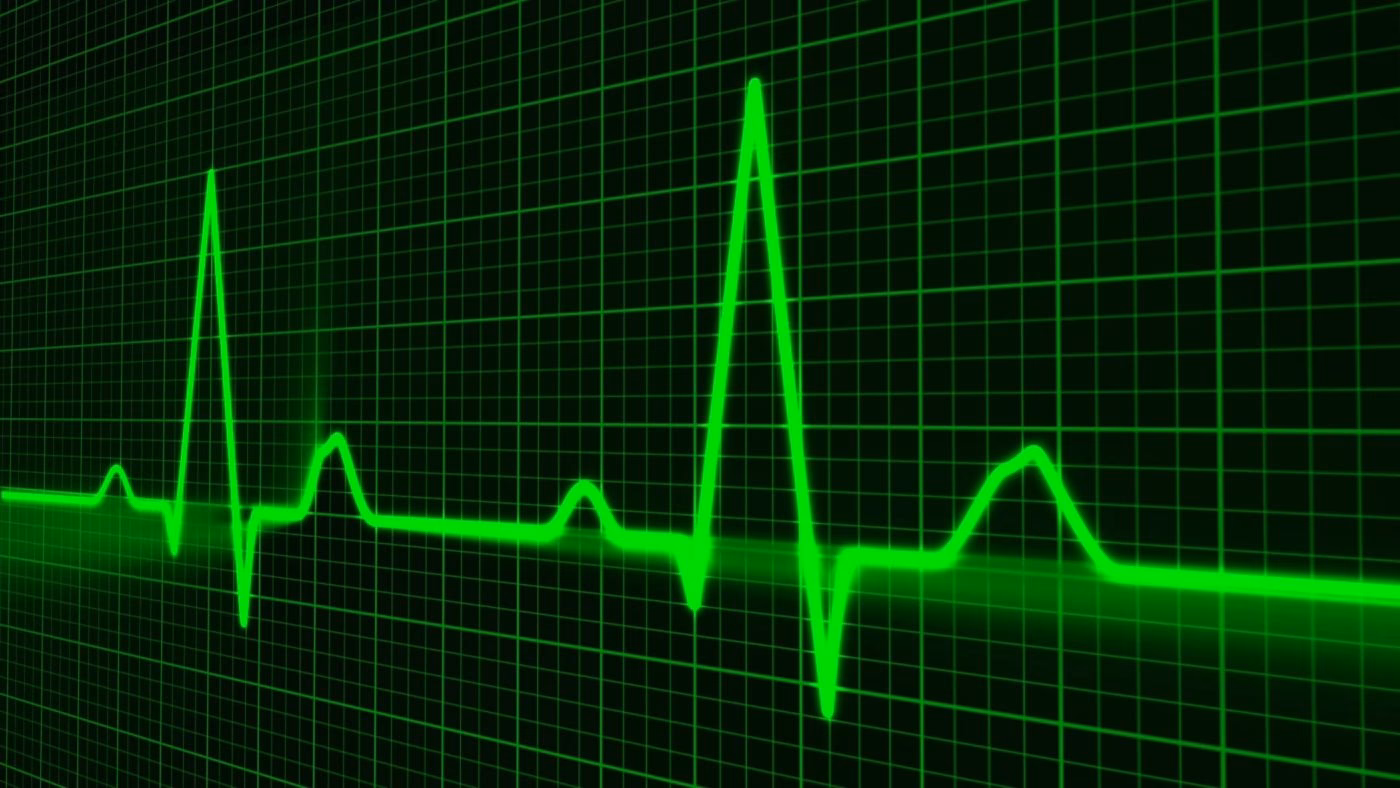 What are the symptoms of epilepsia?