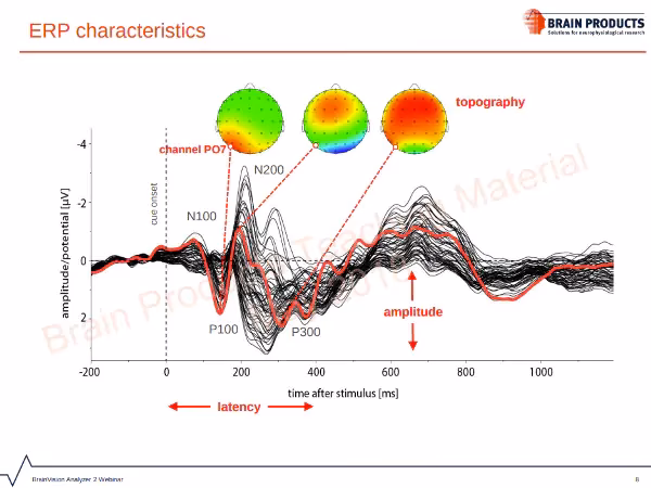 ¿Qué significa ERP en neurología?