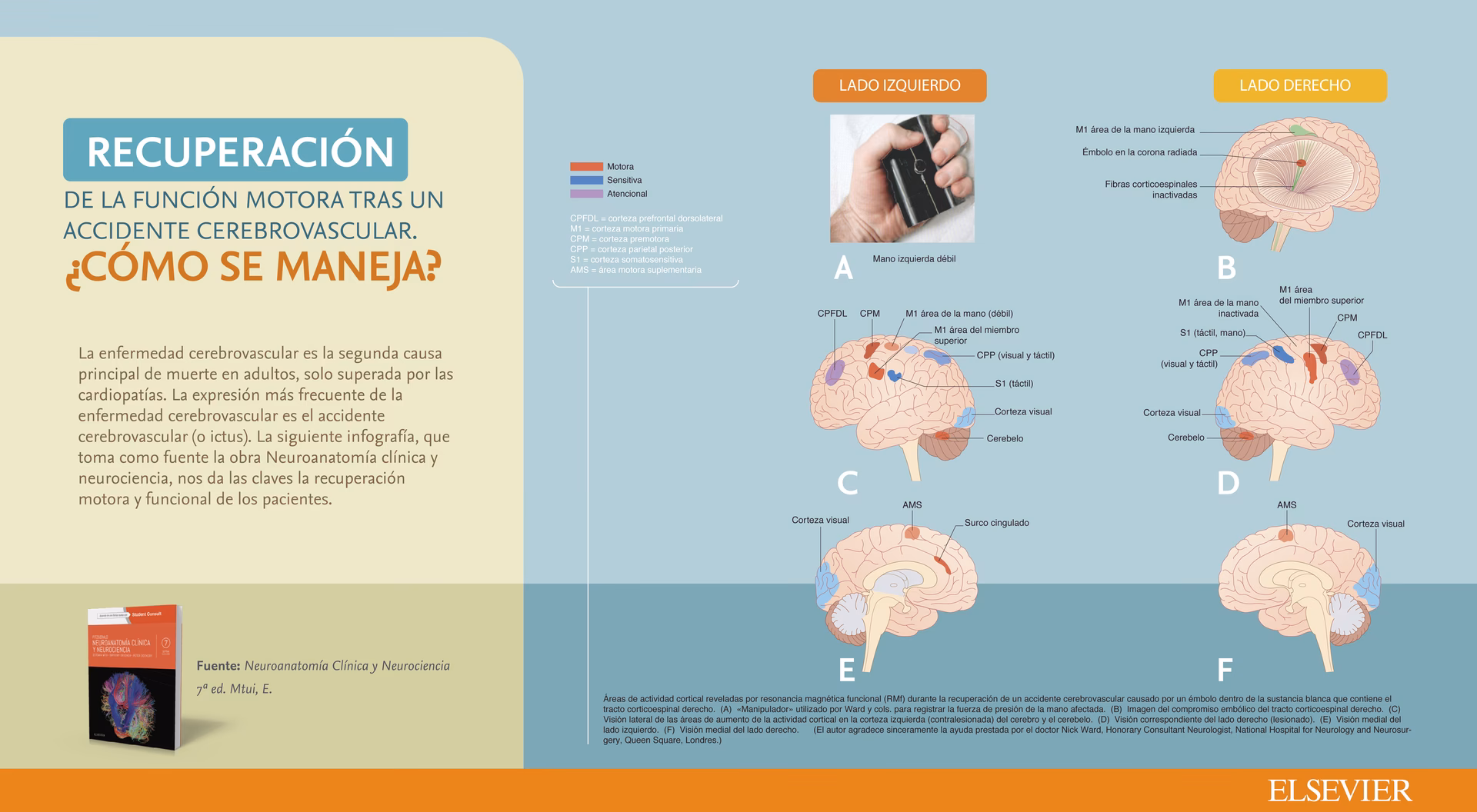 ¿Qué es EVC según la OMS?