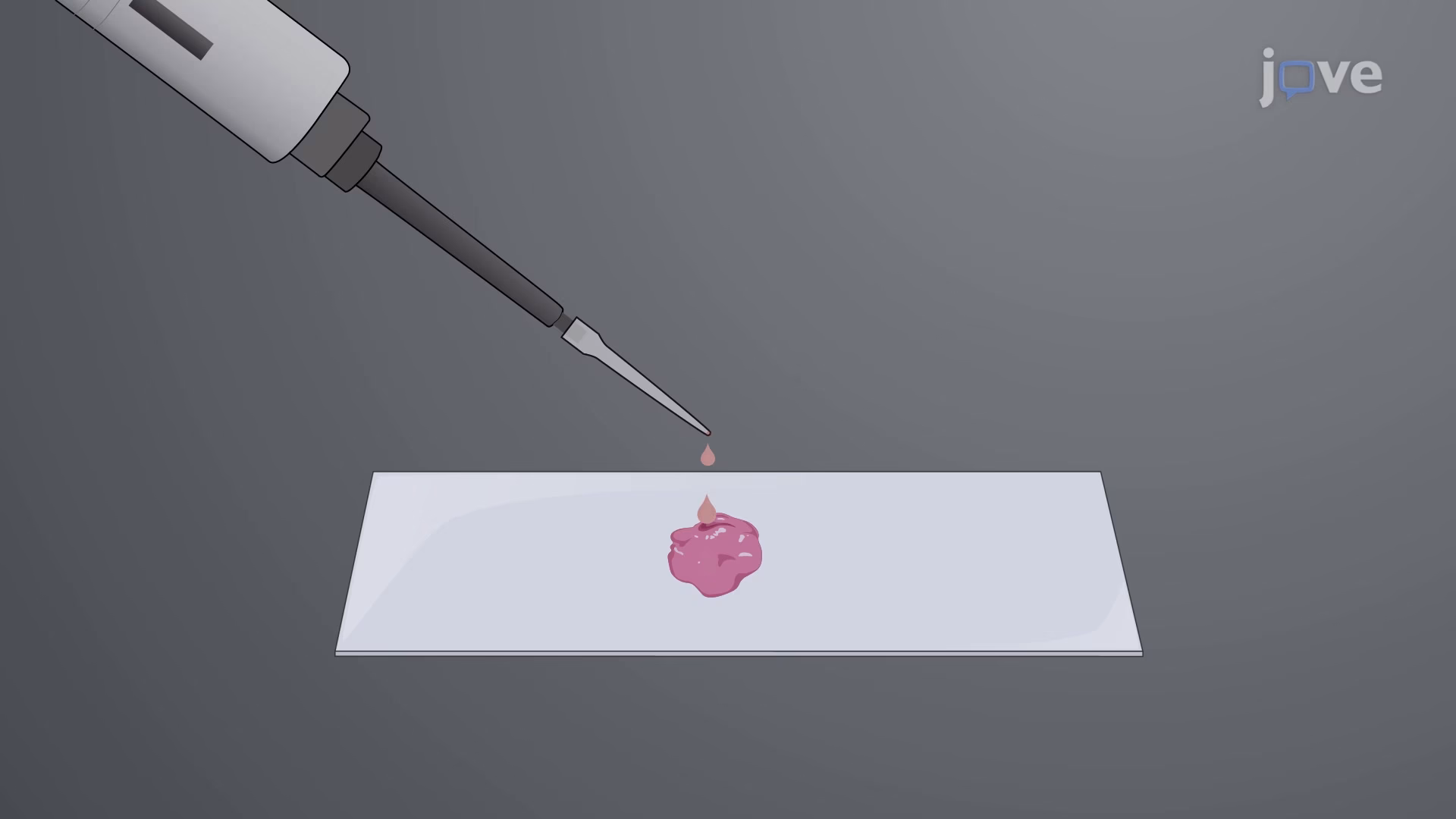 ¿Qué es la tinción neuronal?