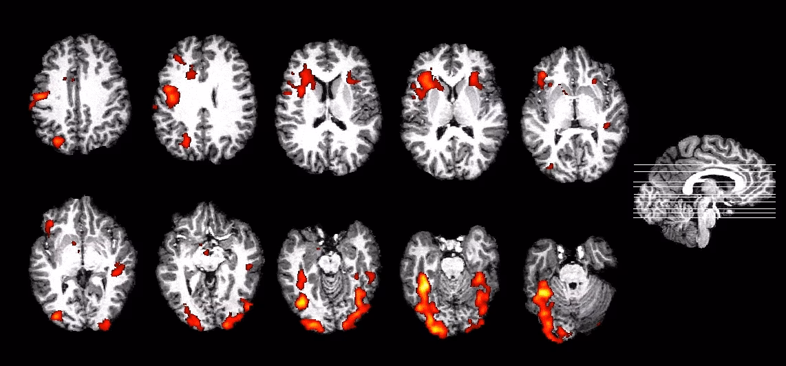 How is fMRI used in cognitive neuroscience?