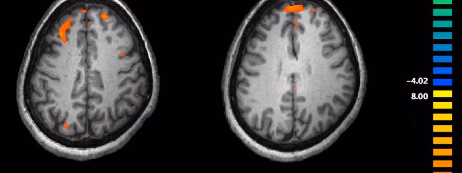 What is the basic principle of fMRI?