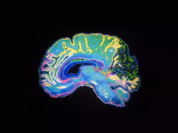 How do you abbreviate Behavioral Neuroscience?