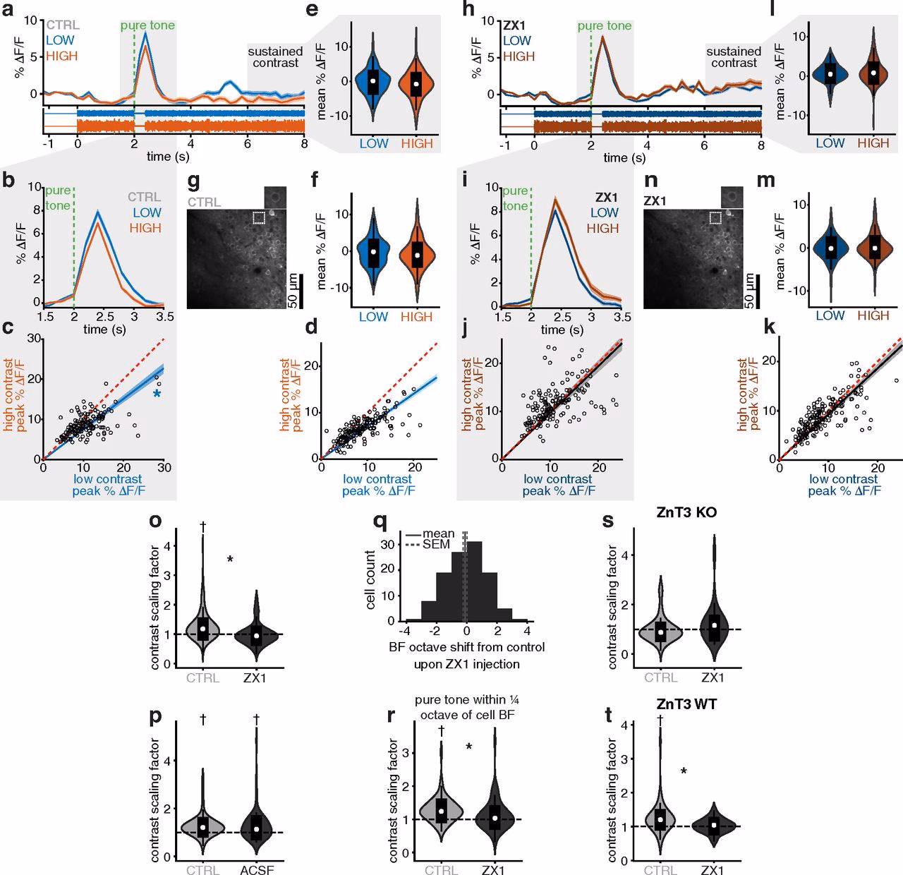 What is the gain control in the sensorimotor system?