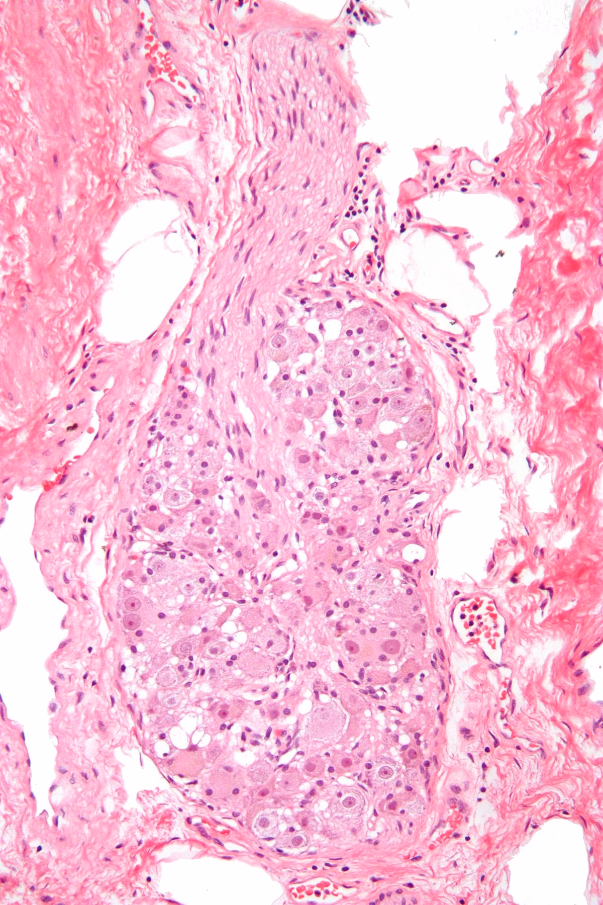 What is a ganglion neuroscience?