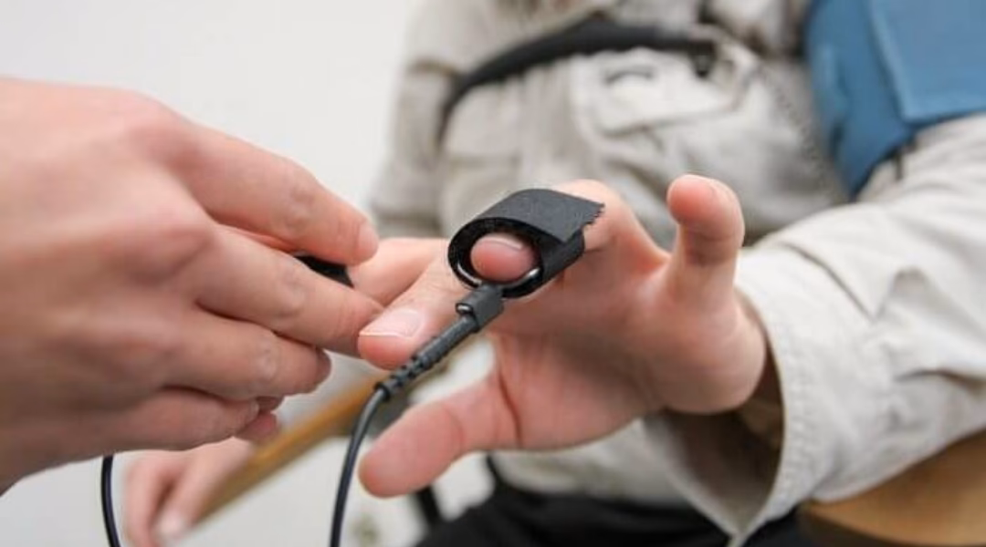 What is a normal GSR value?