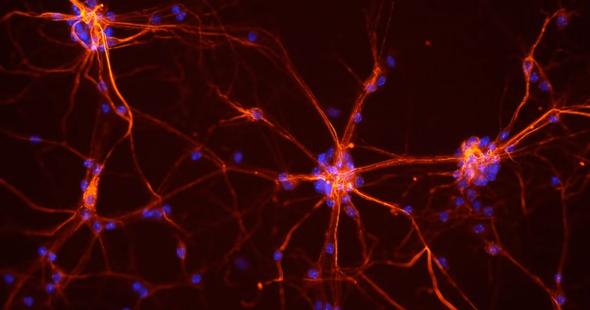 ¿Qué es la teoría neuropsicológica de Hebb?