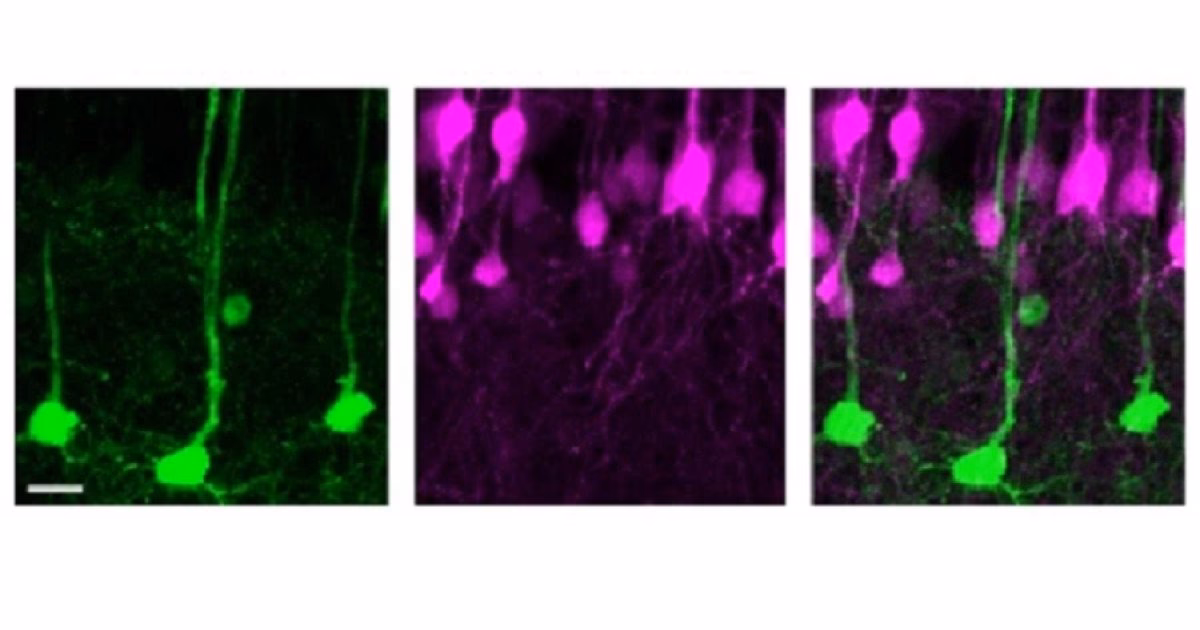 ¿Cuáles son los 10 tipos de células del cuerpo humano?