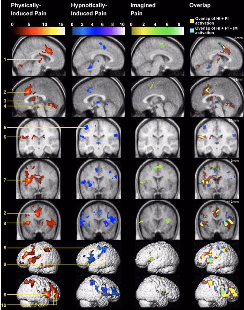 Is hypnosis scientifically accepted?