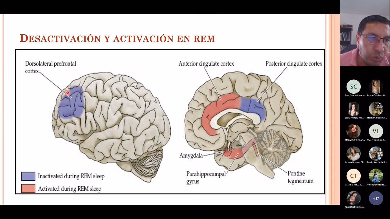 ¿Qué trastorno neurológico afecta el sueño?