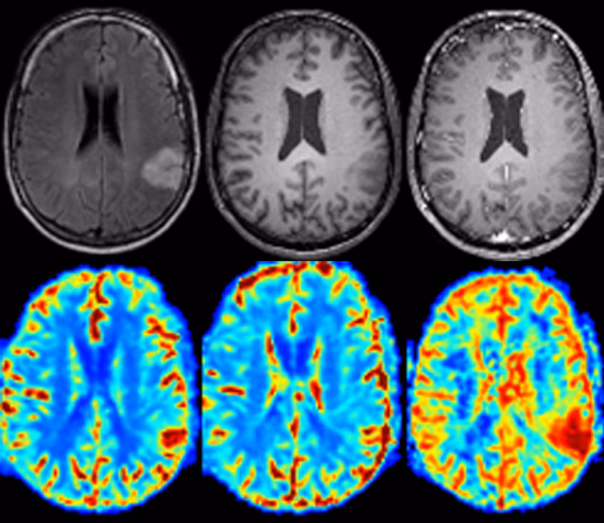 What MRI is used to diagnose?