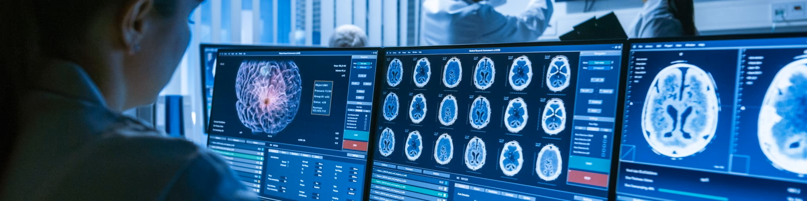 What is Keele Psychology with neuroscience?